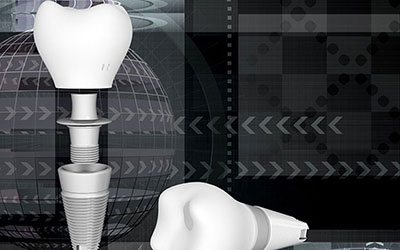 Dental Implants Westwood